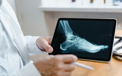 Entrenar con metástasis óseas: cómo moverte con seguridad sin renunciar a la fuerza
