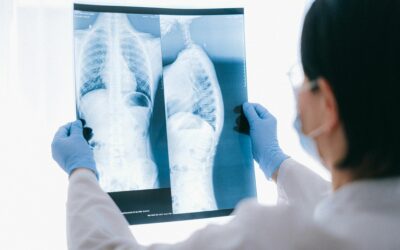 Rehabilitación tras cirugía de pulmón: ejercicios para recuperar la respiración y la capacidad funcional