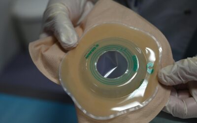 Ejercicio y ostomía: cómo entrenar con seguridad y fortalecer el abdomen tras una colostomía o ileostomía